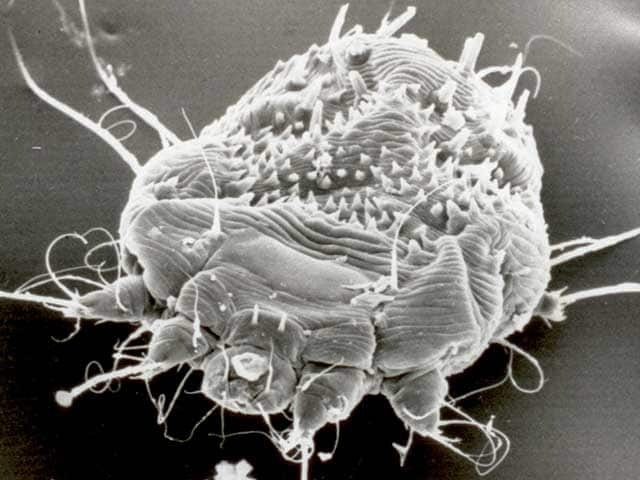 As imagens da escabiose feitas com microscópio eletrônico mostram detalhes do ácaro causador da doença que não podem ser vistos a olho nu. Embora essas imagens sejam impressionantes, o diagnóstico costuma ser feito pelo exame clínico da pele.